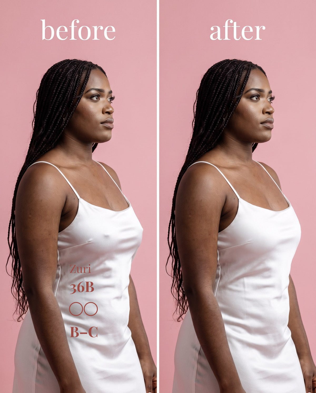 The Original Sticky Boobs, Dark shade, size B-C (8cm) — before and after under a white slip dress 